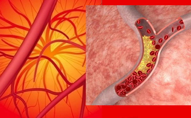 Damarları təmizləmək vaxtıdır! Məşhur alimin resepti